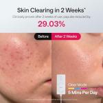 Ulike ReGlow LED Light Therapy Mask, Red Light Therapy for Face, 4 Modes with Red, Blue, Yellow & Infrared Lights for Reduce Acne & Anti-Aging, Eye-Protection, 272 Beads, Remote Control,White