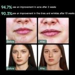 Aphrona® | FDA cleared Moonlight LED Facial Mask Skin Care Mask, LED Light Therapy Red Blue light for Acne Removal Wrinkle Reduction