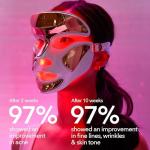 Dr. Dennis Gross DRx SpectraLite FaceWare Pro – LED Face Mask for Skin Rejuvenation with Dual Red & Blue Light Therapy, FSA HSA Eligible