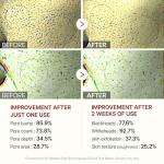 Dr.Melaxin Peel Shot Glow White Rice Peeling Ampoule 80ml, Dead Skin Gentle Exfoliating Ampoule with Rice Water Extract, AHA BHA, Niacinamide, Daily Skin Texture Care, All Skin Types, Korean Skincare