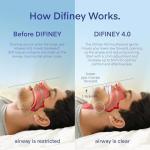 Difiney Advanced Anti Snoring Device 4.0: FDA-Cleared Snoring Solution – Adjustable Snore Stopper Mouth Guard for Men & Women – Anti Snoring Mouthpiece to Improve Sleep – Reusable Night Use
