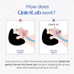 QuietLab Pro Anti-Snoring Mouthpiece - Adjustable Snoring Mouth Guard, Orthodontist Designed, No Boiling Required - BPA-Free Medical Grade - Designed for Nighttime Snoring Control