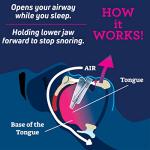 Customizable Anti-Snore Mouthpiece for Better Sleep