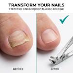 Ergonomic Non-Slip Wide Jaw Nail Clippers