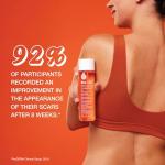 Bio-Oil Skin Repair Oil for Scars & Stretch Marks