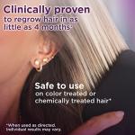 Minoxidil 2% Hair Regrowth Treatment for Women