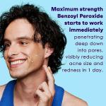 Clean & Clear Maximum Strength Acne Spot Treatment