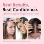 ForChics Women's Hair Growth Serum 50ml