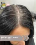 Opti Shampoo for Hair Growth and Vitality