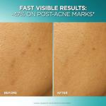 L'Oreal Paris Bright Reveal Dark Spot Exfoliant