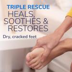 Ultra-Hydrating Foot Cream for Dry Cracked Feet