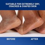 CeraVe Healing Ointment for Dry, Cracked Skin