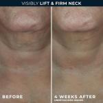 RoC Neck Cream with Hyaluronic Acid & Retinol