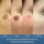 Dark Spot Corrector Serum with Kojic & Azelaic Acid