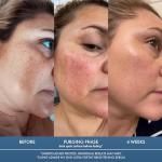 Dark Spot Corrector Serum with Kojic & Azelaic Acid