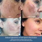 Dark Spot Corrector Serum with Kojic & Azelaic Acid