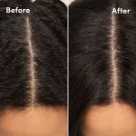 Mizani Calming Scalp Lotion - Soothes Dandruff