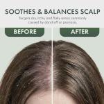 Tea Tree Leave-In Conditioner for Itchy Scalp