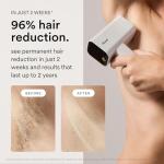 Nood Flasher Pro IPL Laser Hair Removal Device