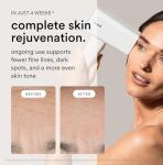 Nood Flasher Pro IPL Laser Hair Removal Device