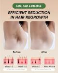 Permanent Hair Removal Device - 999,999 Flashes