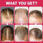 Laser Hair Growth Comb