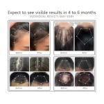 NBWTYA Laser Comb, FDA Cleared Device, Red Light Therapy for Hair Growth, Professional Grade Hair Loss Treatment, Regrows Fuller and Thicker Hair, Reverses Thinning, Stimulates Growth for Men & Women