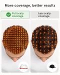iRestore Professional Laser Red Light Therapy for Hair Growth System - FDA Cleared Hair Loss, Hair Thinning & Alopecia Treatment for Men & Women - 282 Lasers & LEDs
