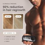 NEW Nood™ Flasher 2.0 + Serum — IPL Laser Hair Removal Device for Women & Men with After Shave to Treat & Prevent Ingrown Hairs, Bumps Slowing Hair Regrowth — Pain-Free IPL Hair Removal — Gloss White