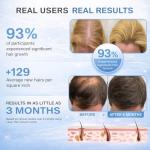 Obiredk Rechargeable Laser Hair Growth Comb