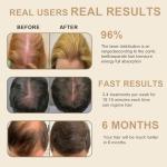 Laser Hair Growth Comb - Fast Results for All
