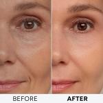 Anti-Aging Retinol Cream with Collagen and Hyaluronic Acid
