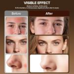 Red Light Therapy Mask with Rechargeable Remote