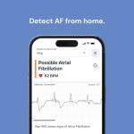 KardiaMobile ECG Heart Monitor with Free KardiaCare