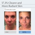 PHA and AHA Lactic Acid Serum for Brightening