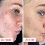 Australian Pink Clay Exfoliating Face Scrub