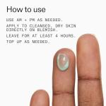 INKEY List Succinic Acid Acne Treatment 15ml