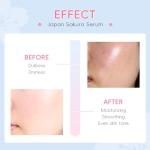 LAIKOU Japan Sakura Serum with Vitamin C & Niacinamide