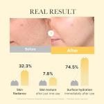 Kojic Acid Turmeric Brightening Overnight Gel Mask