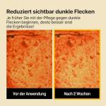 SOME BY MI Yuja Niacin Anti-Blemish Mask Sheets