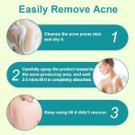 Tea Tree Oil Back Acne Treatment Spray