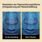 SOME BY MI Yuja Niacin Anti-Blemish Mask Sheets