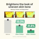 AXIS-Y Glow Serum for Dark Spot Correction