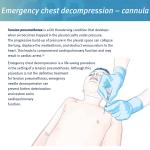 Sanke Rescue Pneumothorax Needle for First Aid