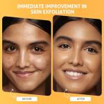 Pumpkin Enzyme Mask, Brightening Exfoliating Facial Mask For Dead Skin,Dullness Dark Spots, Uneven Skin Tone,Large Pores and Brightens Skin, Enzyme Exfoliant for Face, 100g