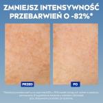 Nivea Cellular Luminous 630 anti-pigment spot intensive serum (30 ml), brightening serum for an even and radiant complexion, face care against pigment spots.