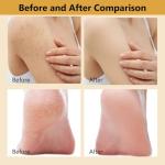 2Pcs Peel Shot Glow Turmeric Serum + Body Exfoliator Solution, Soft Exfoliating Body & Face Peel for Smooth, Glowing Skin, Improve Uneven Skin Tone and Exfoliate