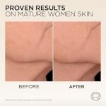 L'Oréal Paris Peptide Serum for Lifting, Age Perfect Micro-Collagen Rejuvenating & Lifting Serum, Firms Sagging Skin, Boosts Radiance & Reduces Age Spots, 30ml