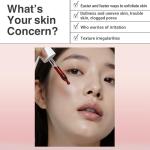 HEIMISH RX AHA BHA 30% Peeling Serum - Wash-off Peeling Serum, Chemical Peel for Blackheads, Pore and Sebum, Gentle Face Exfoliant for Oily and Acne-prone skin, Korean Skincare, 35ml (1.18 fl. oz)