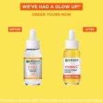 Garnier Vitamin C Serum for Face, Brightening Serum with 4% [Vitamin C + Niacinamide + Salicylic Acid], Hyperpigmentation and Dark Spot Reducer & Evens Skin Tone, 30ml